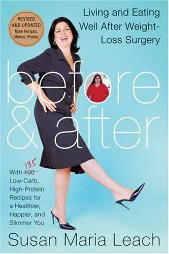 Before & After, Revised Edition (Revised) (Revised) by Leach, Susan Maria