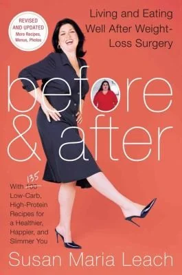 Before & After, Second Revised Edition: Living and Eating Well After Weight-Loss Surgery (Revised)