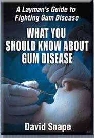 What You Should Know About Gum Disease by Snape, David